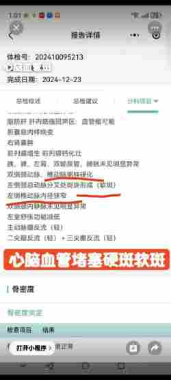论中风偏瘫三高的调理与康复 作者刘建清字号梅山医痴！