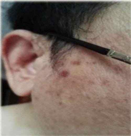 践行“十五五”健康中国战略： 量子氢氧健康第一人廖永贵——用科技点亮生命健康之光