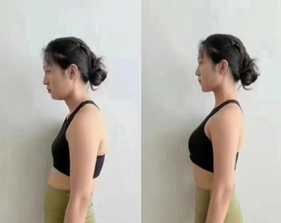 任向苗徒手中医显奇妙