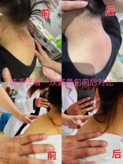 任向苗徒手中医显奇妙