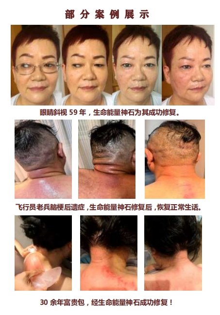 生命能量神石荣获国家科技成果奖，开启能量医学养生新征程