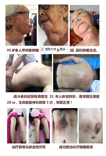 生命能量神石荣获国家科技成果奖，开启能量医学养生新征程