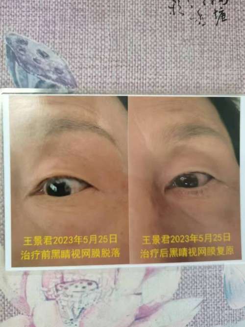 妙手仁心传古方，悬壶济世暖人间——记民间中医苏专荣