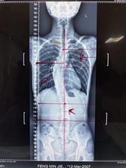 宫廷整脊正骨：王洪喜与通脉整骨堂的百年非遗传承之路