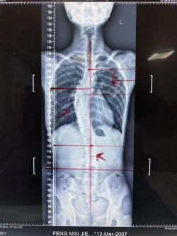 宫廷整脊正骨：王洪喜与通脉整骨堂的百年非遗传承之路