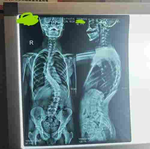 宫廷整脊正骨：王洪喜与通脉整骨堂的百年非遗传承之路