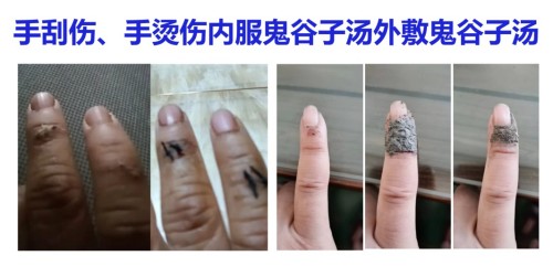 承鬼谷子道医智慧， 以“平火、祝由”破当代健康困局
