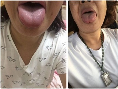 古稀仁医守扶阳正道 妙手回春解百姓疾苦——记山西运城绛县老中医孙政权
