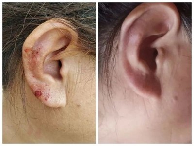 古稀仁医守扶阳正道 妙手回春解百姓疾苦——记山西运城绛县老中医孙政权